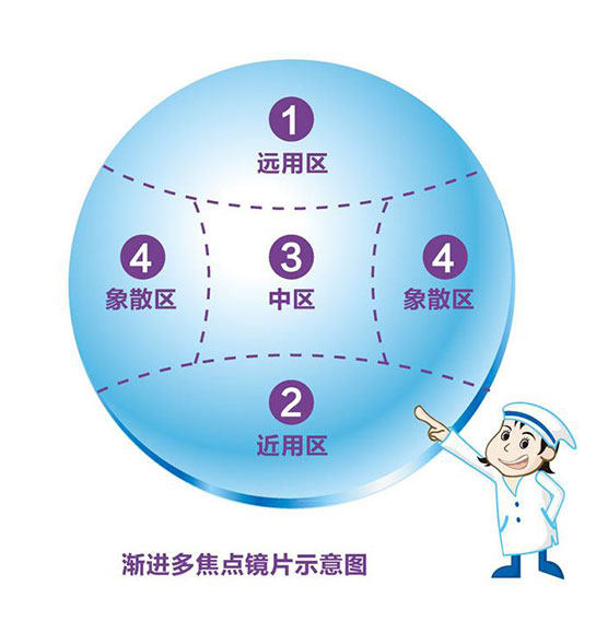 漸進(jìn)多焦鏡 漸進(jìn)多焦鏡